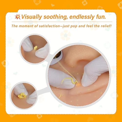 brenzo 2026 New Refillable Pimple Popping Toy – Big Head Squeeze Toy with Golden Hair for Stress & Anxiety Relief, Realistic Pus Burst Fidget Toy, Funny Gag Gift for Adults - style: B-yellow